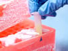STEM-CELLBANKER™ supports therapy development for Parkinson’s Disease