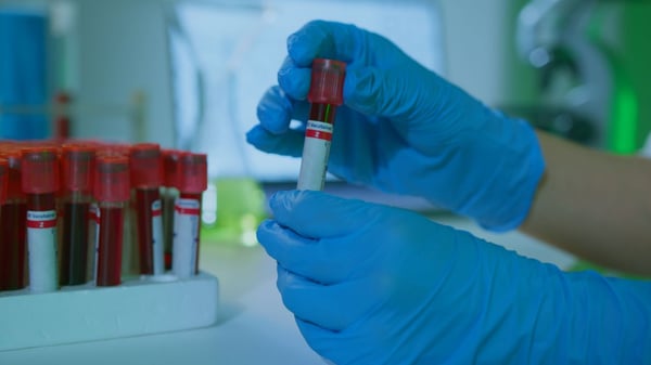 Blutproben für die Forschung: PBMCs, Leukopaks, Plasma & mehr