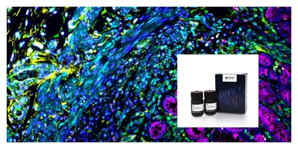 VectaPlex™ Antibody Removal Kit: Die bahnbrechende Multi-Fluoreszenzmarkierung