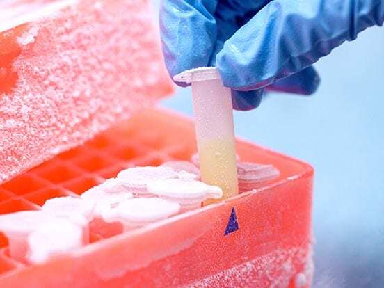 STEM-CELLBANKER™ supports therapy development for Parkinson’s Disease