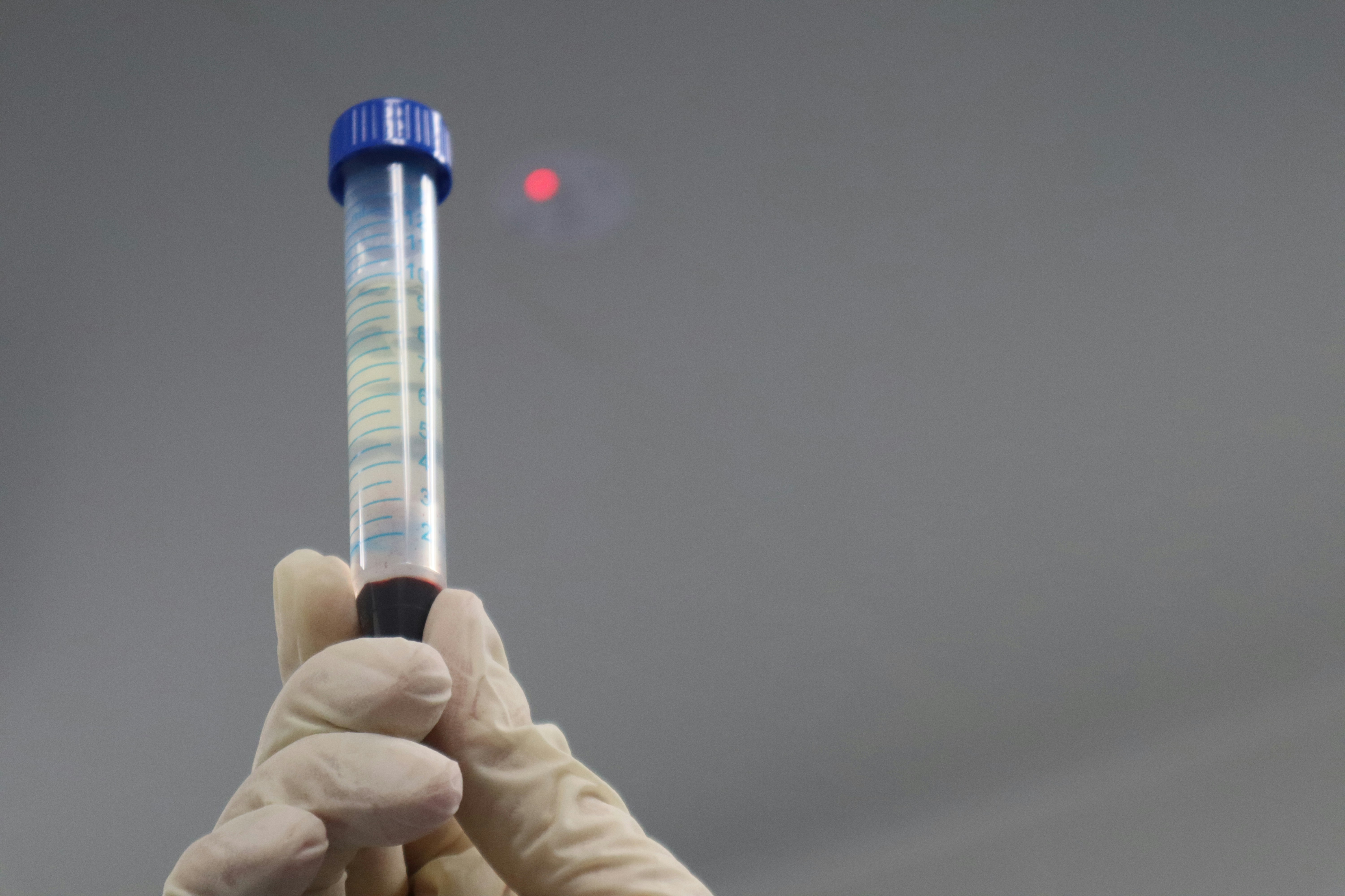 Blood Samples for Research: PBMCs, Leukopaks, Plasma & More