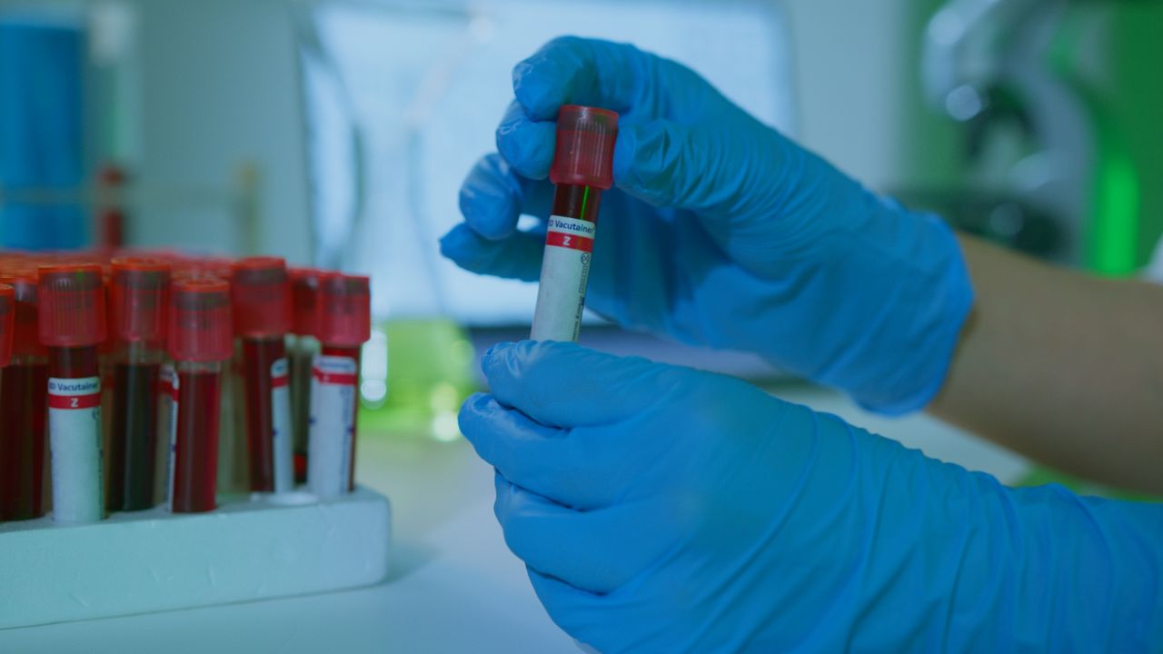 Blood Samples for Research: PBMCs, Leukopaks, Plasma & More